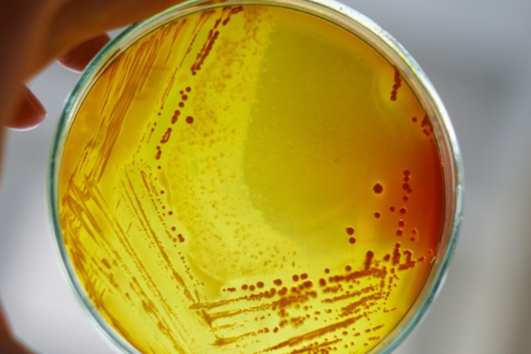 UK antibiotic subscription model key to supporting antibiotic investment