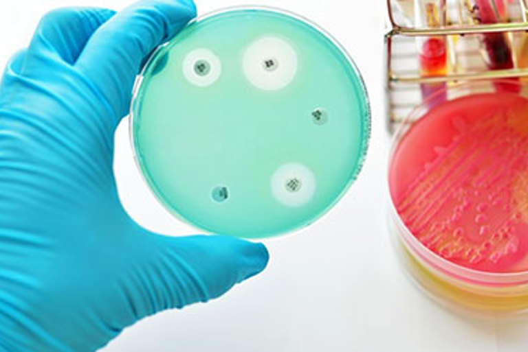 Petri dish 